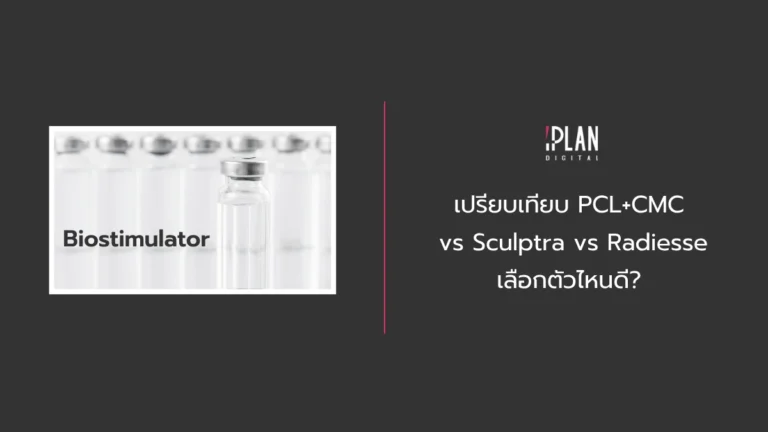เปรียบเทียบ PCL+CMC vs Sculptra vs Radiesse เลือกตัวไหนดี? 5 - เปรียบเทียบ PCL+CMC vs Sculptra vs Radiesse เลือกตัวไหนดี