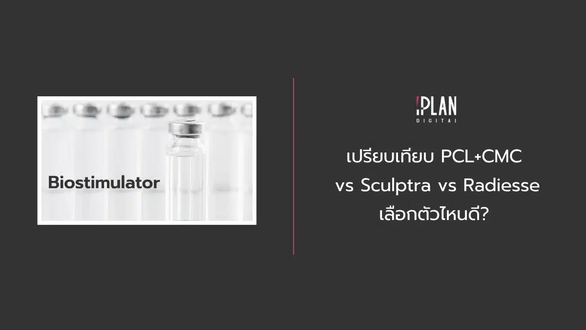 เปรียบเทียบ PCL+CMC vs Sculptra vs Radiesse เลือกตัวไหนดี? 1 - เปรียบเทียบ PCL+CMC vs Sculptra vs Radiesse เลือกตัวไหนดี